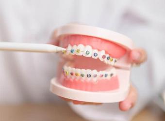 Transform Your Smile: A Comprehensive Look at Orthodontic Care